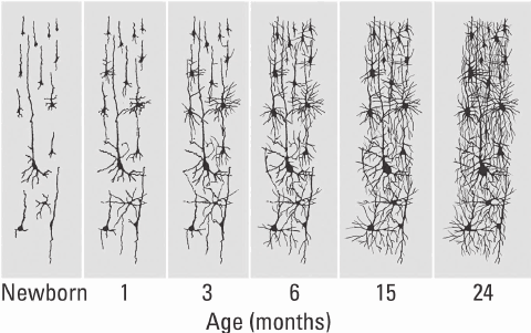 Figure 1. Neonatal cortical development in Broca's Area. Visible connection increase in the brain area responsible for generation of speech